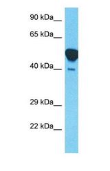Western blot of NECA1 Antibody with human Thymus Tumor lysate.