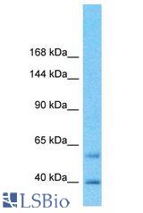 NECAB1 antibody Western Blot of Fetal Kidney. Antibody dilution: 1 ug/ml.