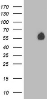 HEK293T cells were transfected with the pCMV6-ENTRY control (Left lane) or pCMV6-ENTRY PVRL1 (Right lane) cDNA for 48 hrs and lysed. Equivalent amounts of cell lysates (5 ug per lane) were separated by SDS-PAGE and immunoblotted with anti-PVRL1.