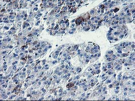 IHC of paraffin-embedded Carcinoma of Human liver tissue using anti-PVRL1 mouse monoclonal antibody.