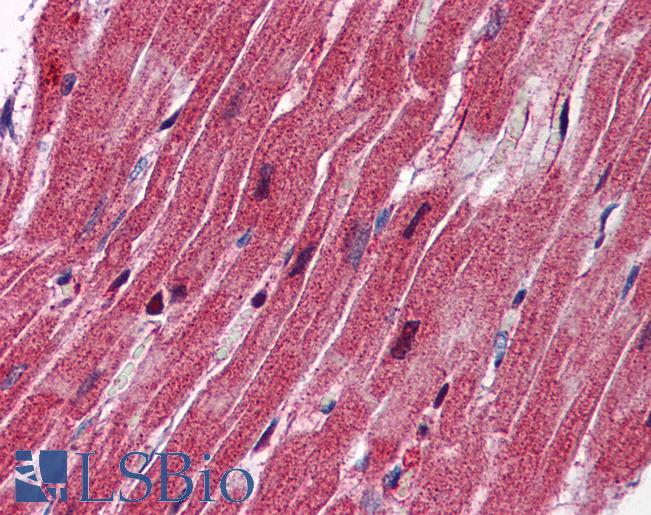 Anti-Nestin antibody IHC of human heart. Immunohistochemistry of formalin-fixed, paraffin-embedded tissue after heat-induced antigen retrieval. Antibody LS-B5875 concentration 2.5 ug/ml.