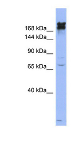 NES / Nestin antibody LS-B5875 Western blot of OVCAR-3 cell lysate.