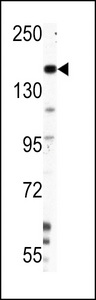 Western blot of Nestin Antibody (S1409) in HepG2 cell line lysates (35 ug/lane). NES (arrow) was detected using the purified antibody.