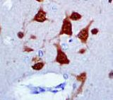 IHC of NeuN on FFPE Brain tissue.