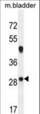 NCALD Antibody western blot of mouse bladder tissue lysates (35 ug/lane). The NCALD antibody detected the NCALD protein (arrow).