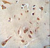 SERPINI1 antibody immunohistochemistry of formalin-fixed and paraffin-embedded human brain tissue followed by peroxidase-conjugated secondary antibody and DAB staining.