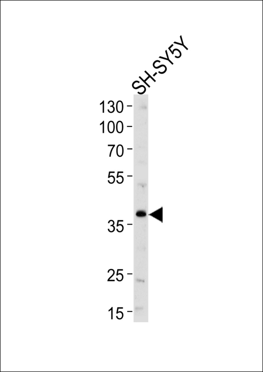 Western blot of lysate from SH-SY5Y cell line, using SERPINI1 Antibody. Antibody was diluted at 1:1000 at each lane. A goat anti-rabbit IgG H&L (HRP) at 1:5000 dilution was used as the secondary antibody. Lysate at 35ug per lane.