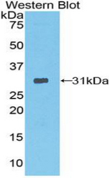 Western blot of recombinant Neurotrypsin.