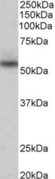 Nprl3 antibody (0.3 ug/ml) staining of Human Heart lysate (35 ug protein in RIPA buffer). Primary incubation was 1 hour. Detected by chemiluminescence.
