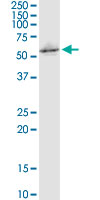 C16orf35 monoclonal antibody (M02), clone 4E6. Western Blot analysis of C16orf35 expression in IMR-32.