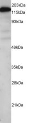 (0.1 ug/ml) Staining of Human Testis lysate (RIPA buffer, 1.4E5 cells per lane). Detected by chemiluminescence.