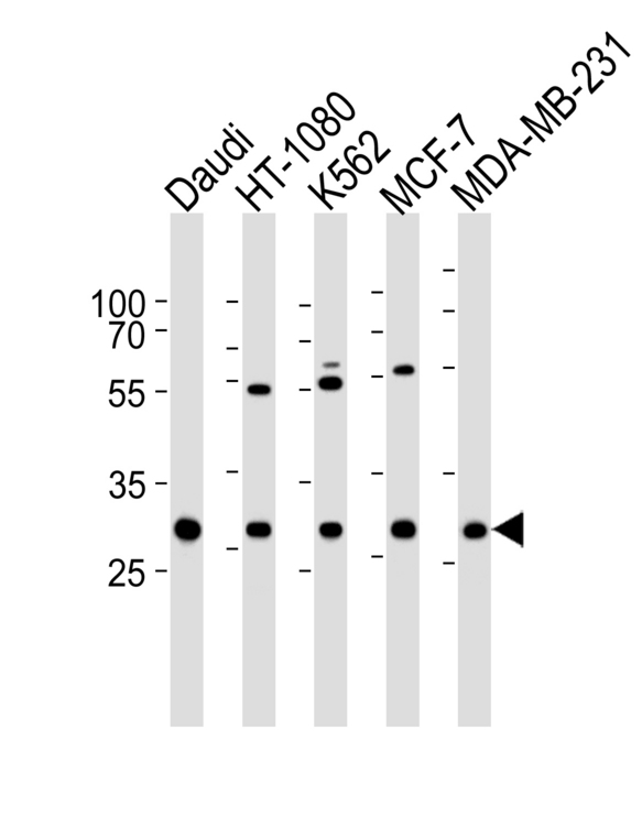 Western blot of lysates from Daudi, HT-1080, K562, MCF-7, MDA-MB-231 cell line (from left to right) with PNP Antibody. Antibody was diluted at 1:1000 at each lane. A goat anti-rabbit IgG H&L (HRP) at 1:5000 dilution was used as the secondary antibody. Lysates at 35 ug per lane.