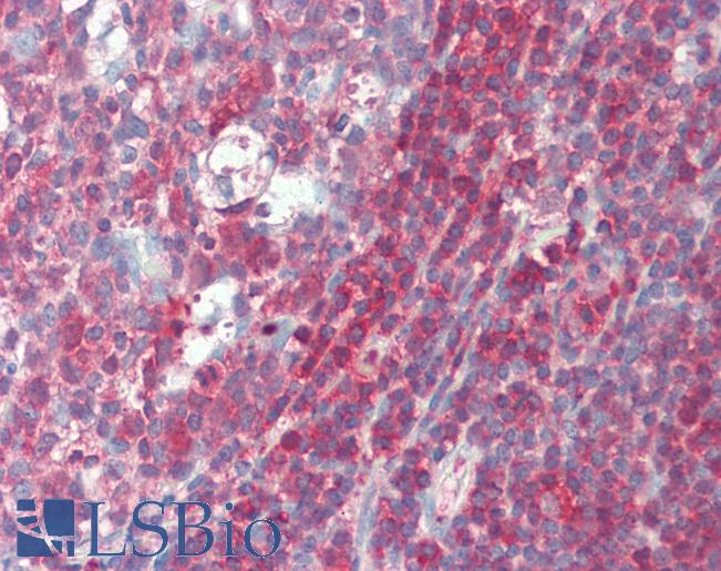 Human Tonsil: Formalin-Fixed, Paraffin-Embedded (FFPE)