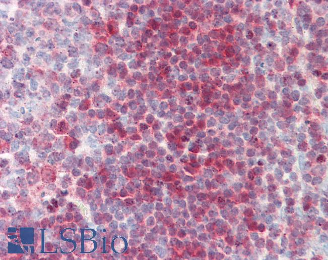 Anti-Nucleoside Phosphorylase / PNP antibody IHC staining of human tonsil. Immunohistochemistry of formalin-fixed, paraffin-embedded tissue after heat-induced antigen retrieval.