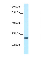 Nudt16 antibody LS-C146148 Western blot of Small Intestine lysate. Antibody concentration 1 ug/ml.