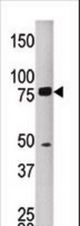 The anti-MELK antibody is used in Western blot to detect MKEL in HEPG2 tissue lysate