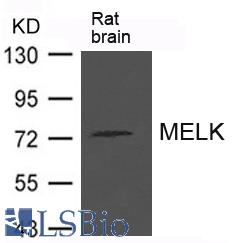Western blot of extract from Rat brain tissue using MELK antibody