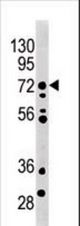 The anti-MRLK antibody is used in Western blot to detect MRLK in mouse brain tissue lysate