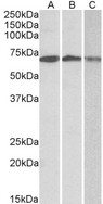 OAS2 antibody (0.3 ug/ml) staining of Daudi (A), Jurkat (B) and K562 (C) lysates (35 ug protein in RIPA buffer). Primary incubation was 1 hour. Detected by chemiluminescence.