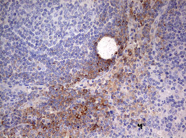 IHC of paraffin-embedded Human lymph node tissue using anti-OAS2 mouse monoclonal antibody. (Heat-induced epitope retrieval by 10mM citric buffer, pH6.0, 120°C for 3min).