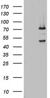 HEK293T cells were transfected with the pCMV6-ENTRY control (Left lane) or pCMV6-ENTRY OAS2 (Right lane) cDNA for 48 hrs and lysed. Equivalent amounts of cell lysates (5 ug per lane) were separated by SDS-PAGE and immunoblotted with anti-OAS2.