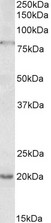 OAS2 antibody (1 ug/ml) staining of Jurkat lysate (35 ug protein in RIPA buffer). Primary incubation was 1 hour. Detected by chemiluminescence.