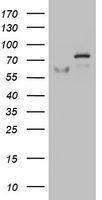 HEK293T cells were transfected with the pCMV6-ENTRY control (Left lane) or pCMV6-ENTRY OAS2 (Right lane) cDNA for 48 hrs and lysed. Equivalent amounts of cell lysates (5 ug per lane) were separated by SDS-PAGE and immunoblotted with anti-OAS2.