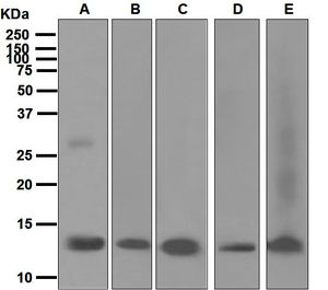 Western blot analysis on (A) human placenta, (B) mouse heart, (C) rat heart, (D) fetal heart, and (E) mouse kidney lysates using anti-Oncomodulin antibody.