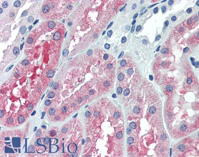 Anti-OCRL antibody IHC of human kidney. Immunohistochemistry of formalin-fixed, paraffin-embedded tissue after heat-induced antigen retrieval. Antibody LS-B6106 concentration 5 ug/ml.