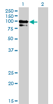 Western blot of OCRL expression in transfected 293T cell line by OCRL monoclonal antibody LS-B6106.