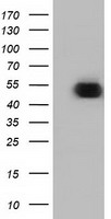 HEK293T cells were transfected with the pCMV6-ENTRY control (Left lane) or pCMV6-ENTRY ODC1 (Right lane) cDNA for 48 hrs and lysed. Equivalent amounts of cell lysates (5 ug per lane) were separated by SDS-PAGE and immunoblotted with anti-ODC1.
