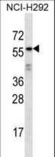 ODF2L Antibody western blot of NCI-H292 cell line lysates (35 ug/lane). The ODF2L antibody detected the ODF2L protein (arrow).