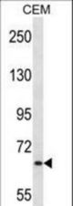 MEN1 Antibody western blot of CEM cell line lysates (35 ug/lane). The MEN1 antibody detected the MEN1 protein (arrow).