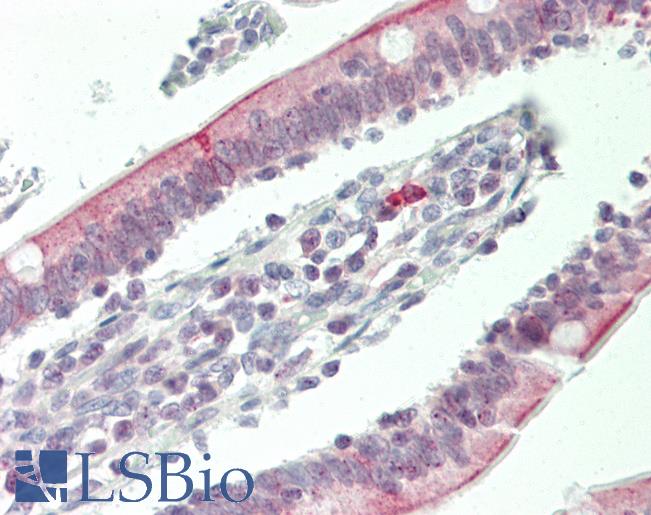 Human Small Intestine: Formalin-Fixed, Paraffin-Embedded (FFPE)