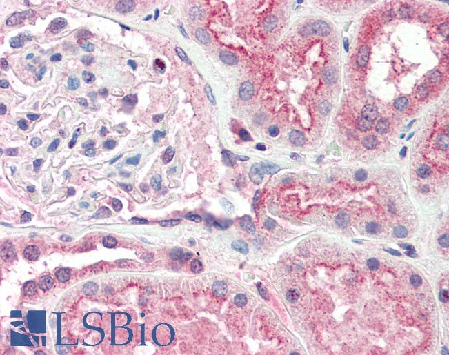 Anti-OGG1 antibody IHC of human kidney. Immunohistochemistry of formalin-fixed, paraffin-embedded tissue after heat-induced antigen retrieval. Antibody LS-B2399 concentration 5 ug/ml.