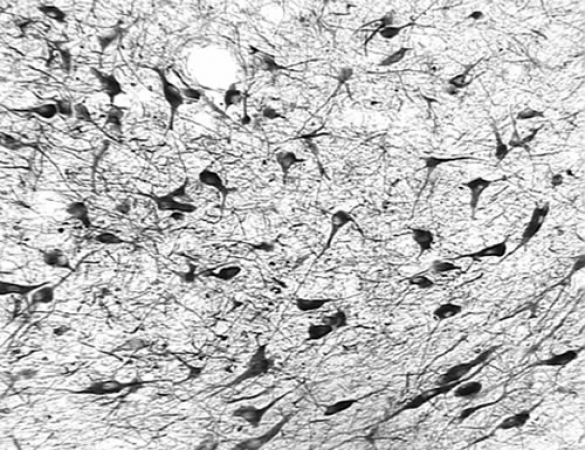 Detection of OGG1 in formaldehyde fixed frozen sections of the substantia nigra from a Rhesus macaque (Macaca mulatta) using antibody at 10 ug/ml.