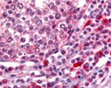 Tonsil, Germinal Center and Mantle Zone 60x.