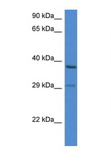 OGG1 antibody LS-C145305 Western blot of ACHN Cell lysate. Antibody concentration 1 ug/ml.