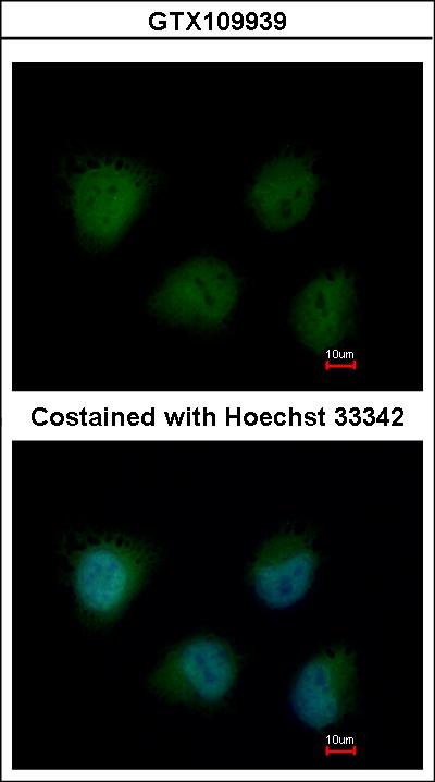Immunofluorescence of paraformaldehyde-fixed HeLa using O-GlcNAc transferase antibody at 1:200 dilution.