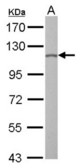 O-GlcNAc transferase antibody detects OGT protein by Western blot analysis. A. 30 ug PC-12 whole cell lysate/extract. 7.5 % SDS-PAGE. O-GlcNAc transferase antibody dilution:1:1000