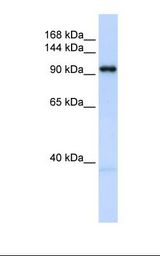 Fetal heart lysate. Antibody concentration: 1.0 ug/ml. Gel concentration: 6-18%.