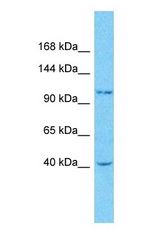 Western blot of OGT Antibody with human MDA-MB-435s Whole Cell lysate.