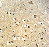 Formalin-fixed and paraffin-embedded human brain tissue reacted with OGT Antibody , which was peroxidase-conjugated to the secondary antibody, followed by DAB staining. This data demonstrates the use of this antibody for immunohistochemistry; clinical relevance has not been evaluated.