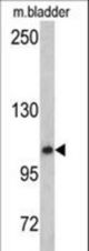 Western blot of OGT antibody in mouse bladder tissue lysates (35 ug/lane). OGT (arrow) was detected using the purified antibody.