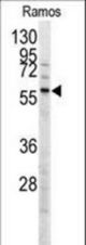 Western blot of anti-MEN1 Antibody (T594) in Ramos cell line lysates (35 ug/lane). MEN1(arrow) was detected using the purified antibody.