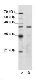 A: Marker, B: HepG2 Cell Lysate