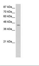 Jurkat Cell Lysate