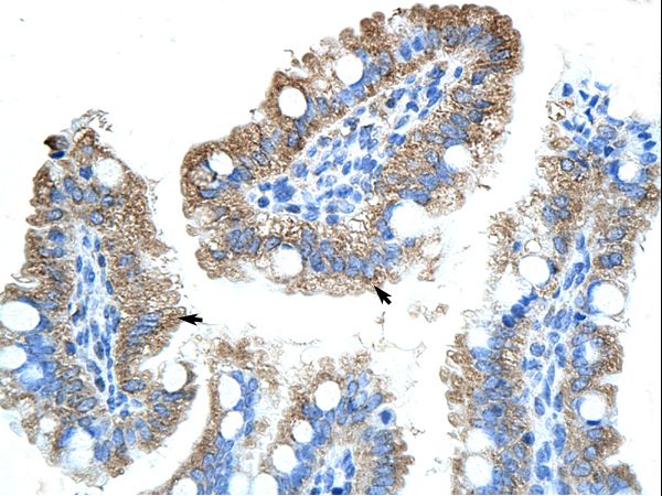 OLA1 / GTPBP9 antibody LS-C30335 was used in IHC to stain formalin-fixed, paraffin-embedded human intestine.