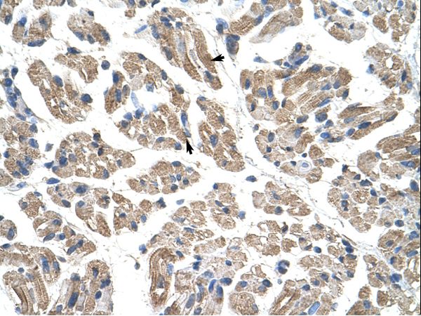 OLA1 / GTPBP9 antibody LS-C31599 was used in IHC to stain formalin-fixed, paraffin-embedded human muscle.