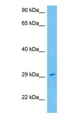 Western blot of OLA1 Antibody with human MCF7 Whole Cell lysate.